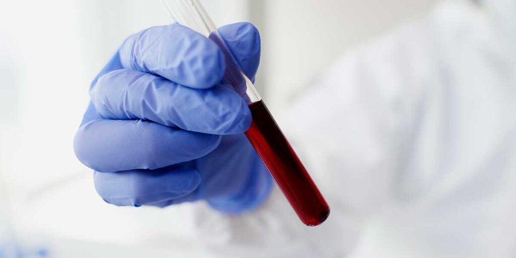 a gloved hand holding a test tube with blood