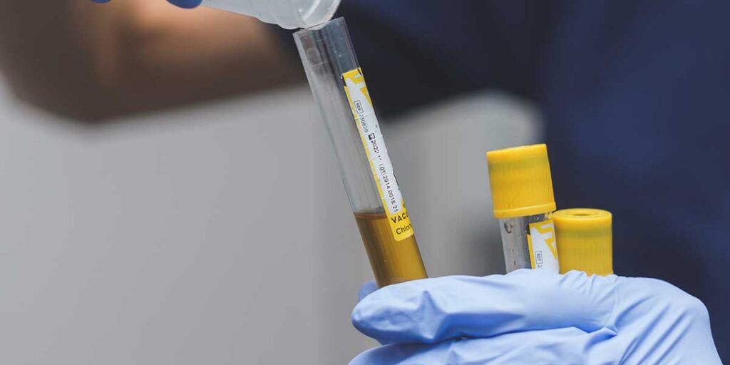 gloved hands pouring urine from a cup into a test tube