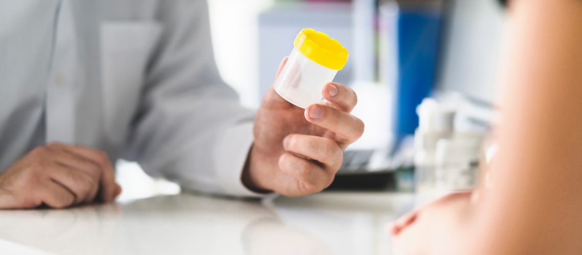 Doctor holding a urine test cup